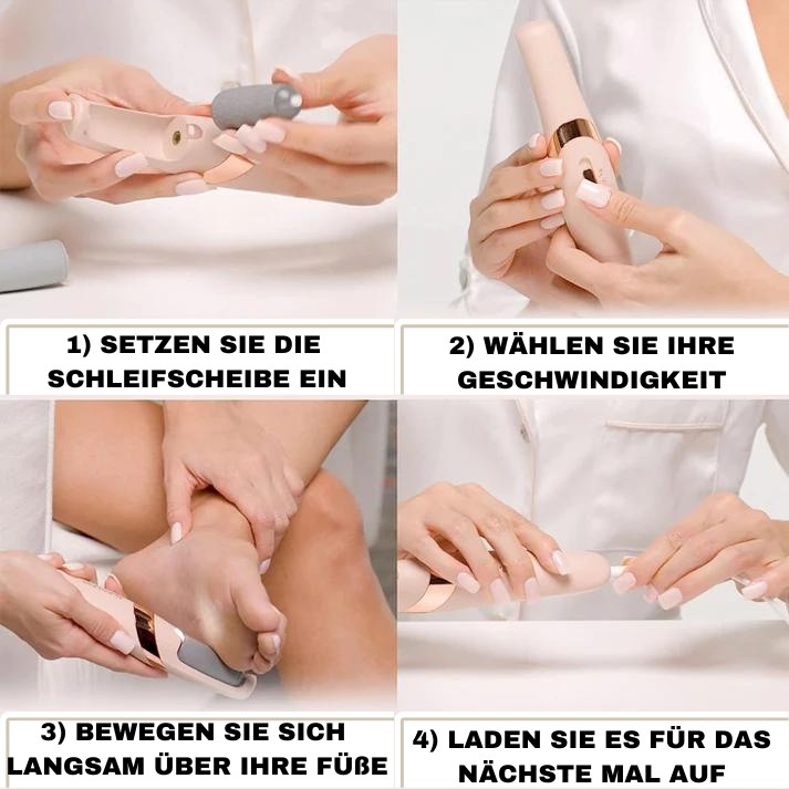 RAMONA - ELEKTRISCHE FUSS-HORNHAUTENTFERNER
