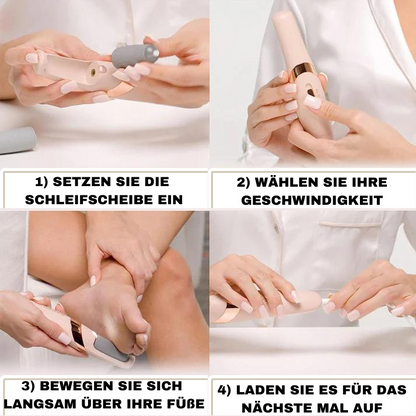 RAMONA - ELEKTRISCHE FUSS-HORNHAUTENTFERNER